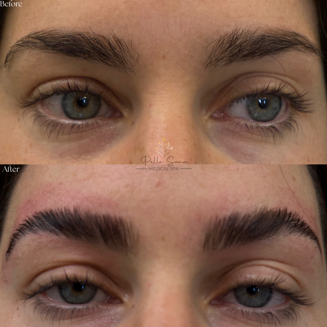 Eyebrow Lamination