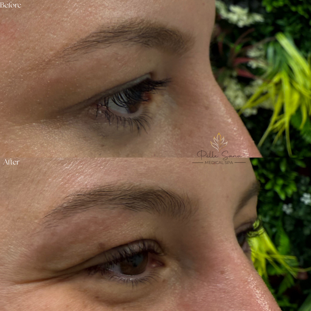 Lash Lift
