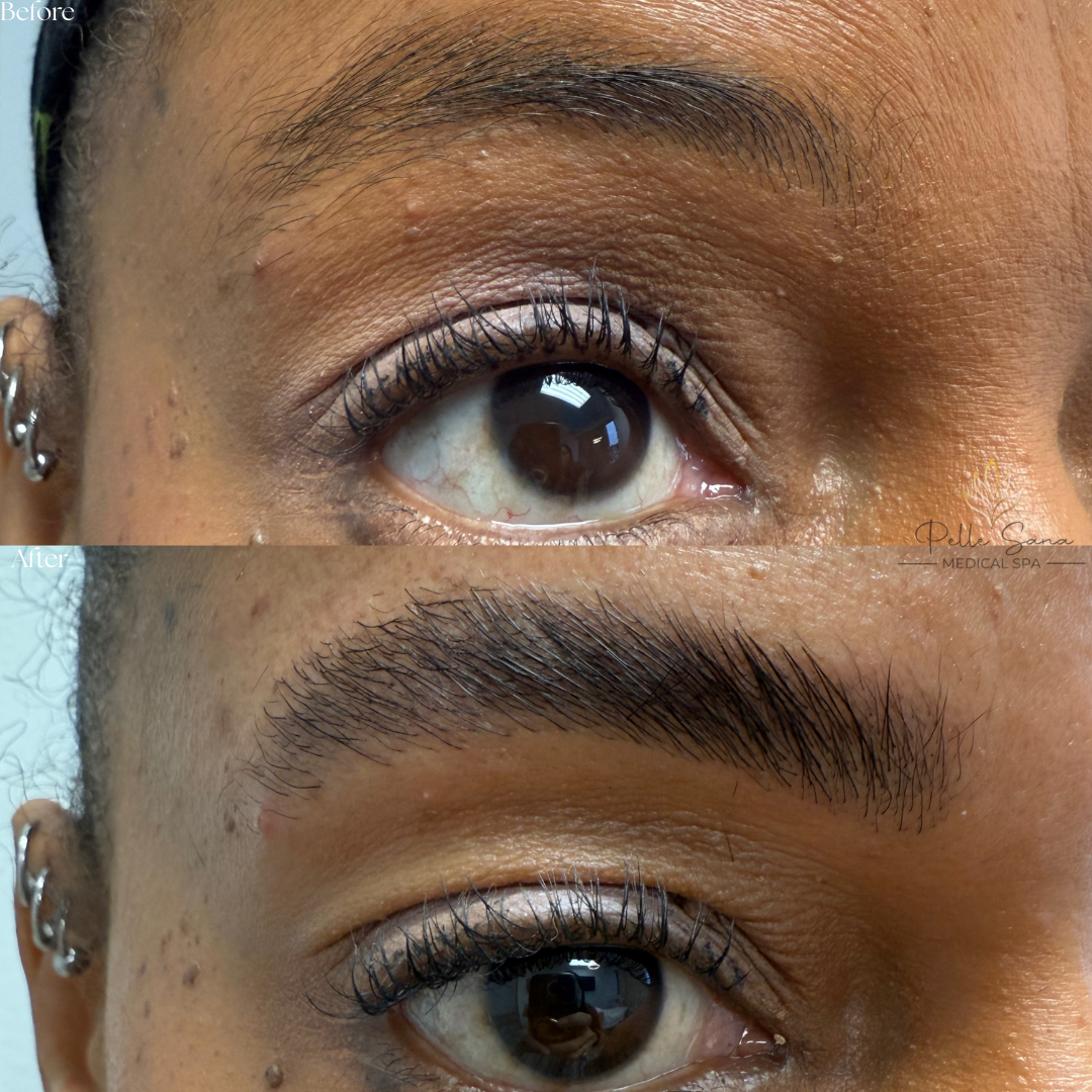 Eyebrow Lamination