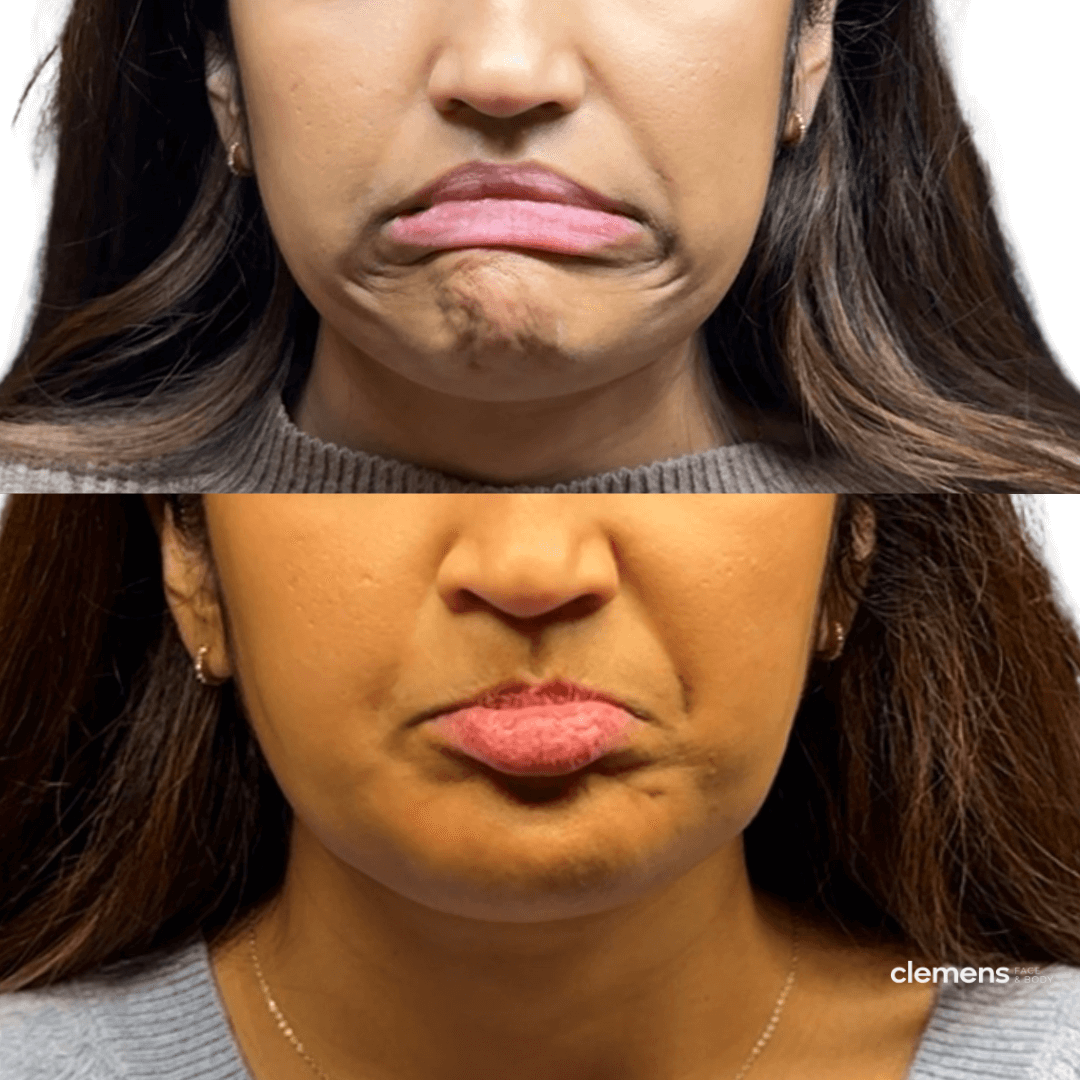 Close-up photos of a woman making different facial expressions, showing a pout and a neutral face.