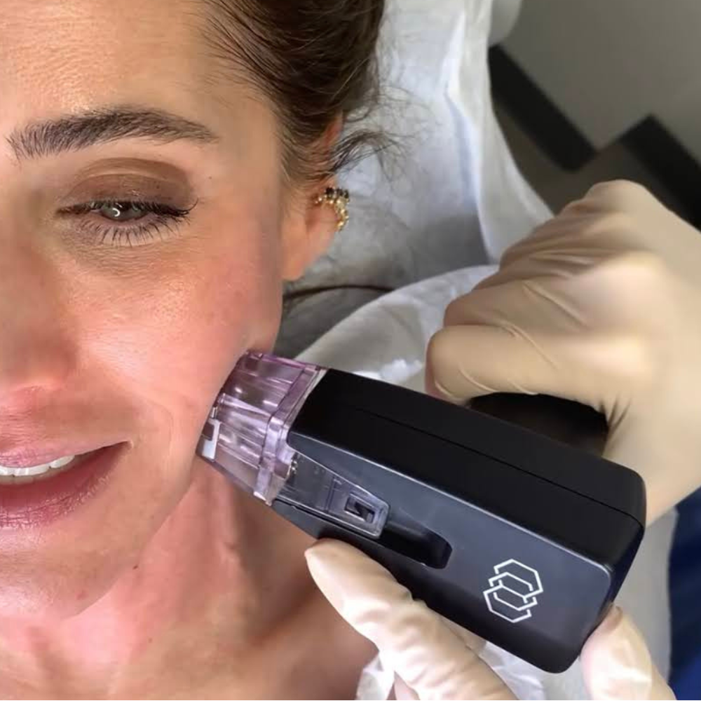 A woman receives a cosmetic treatment with a handheld device during a facial treatment at a spa or clinic.