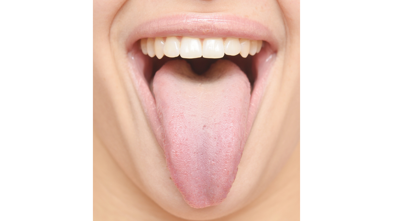 Close-up of a person's mouth with tongue sticking out. Myofunctional Therapy Exercise. Myo.