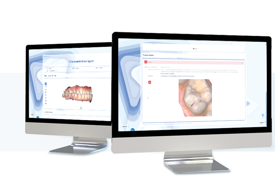 Two computer screens displaying dental examination reports and images of teeth.