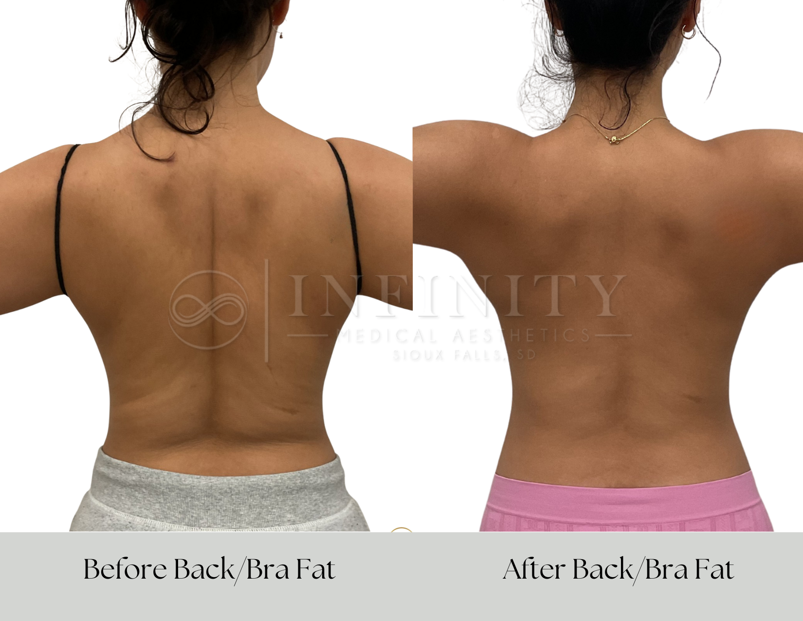 Comparison image showing a person's torso before and after a fitness program, focusing on abdominal area. The left side labeled 'Before Full Abdomen' shows a less defined stomach, while the right side labeled 'After Full Abdomen' shows a more toned and defined abdomen.