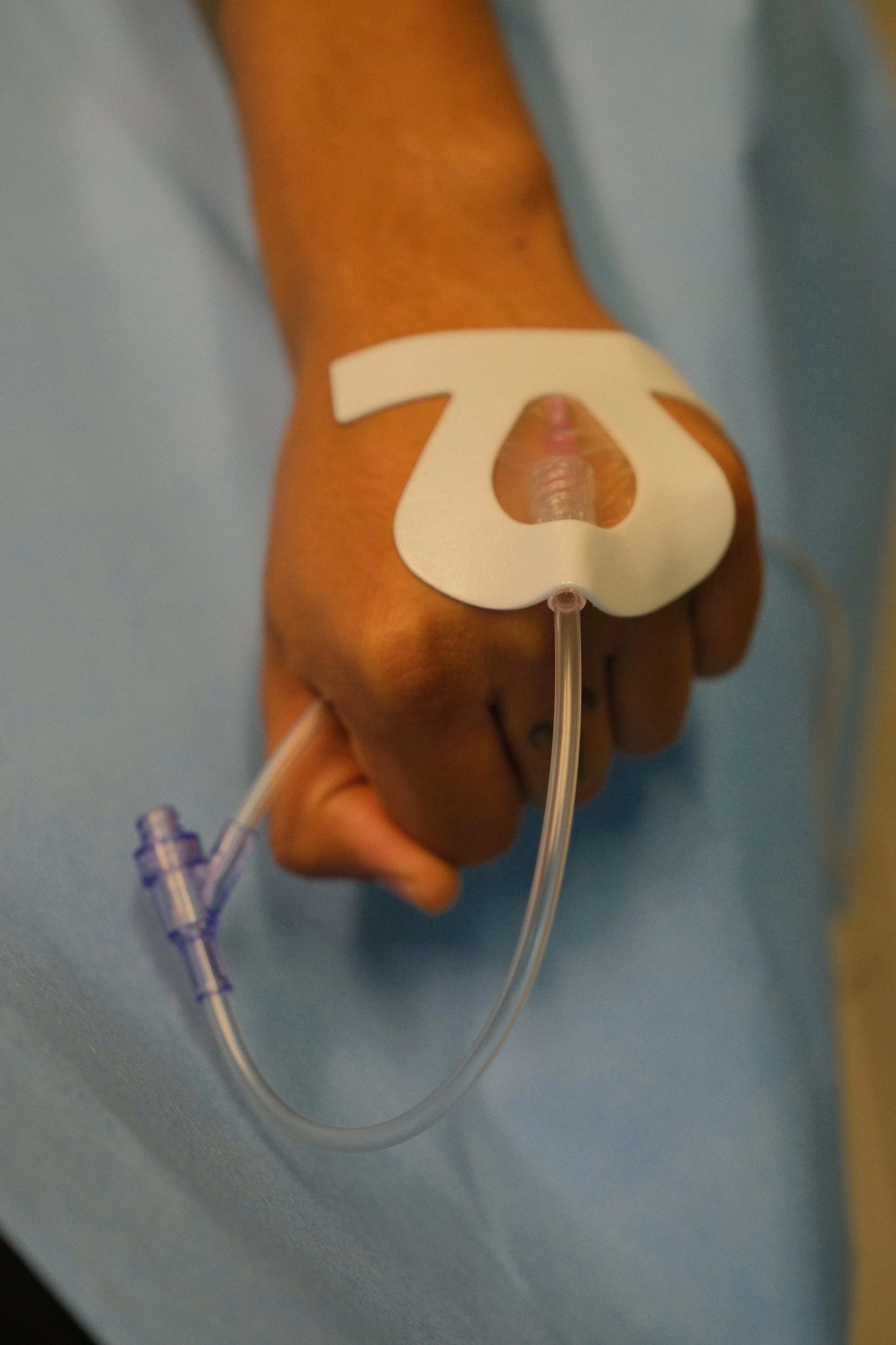A close-up of a person's hand with an IV inserted into the vein, taped with white medical tape, connected to a transparent tube in a hospital setting.