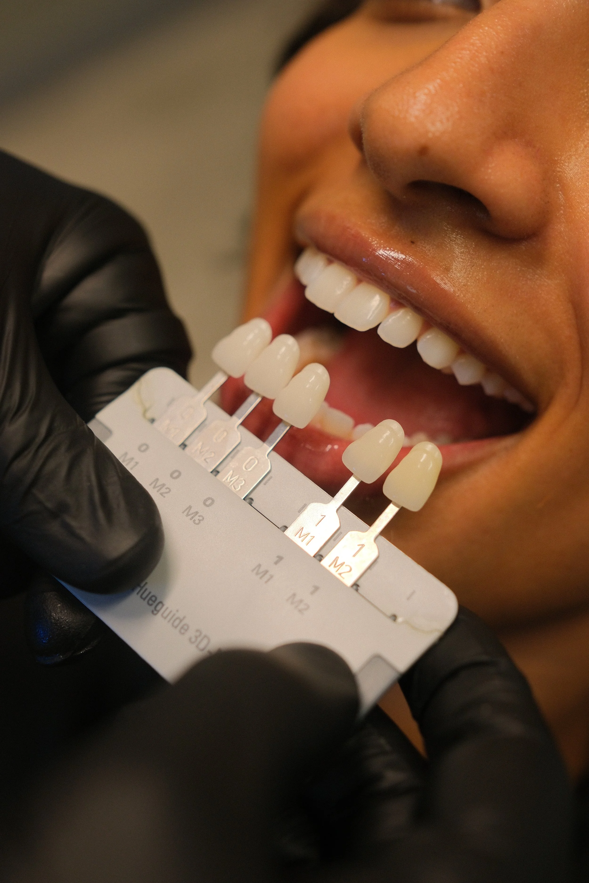 A woman lying back, smiling as a dental professional shows her a shade guide for teeth whitening. The dental professional is wearing pink gloves and holding the shade palette near her teeth.