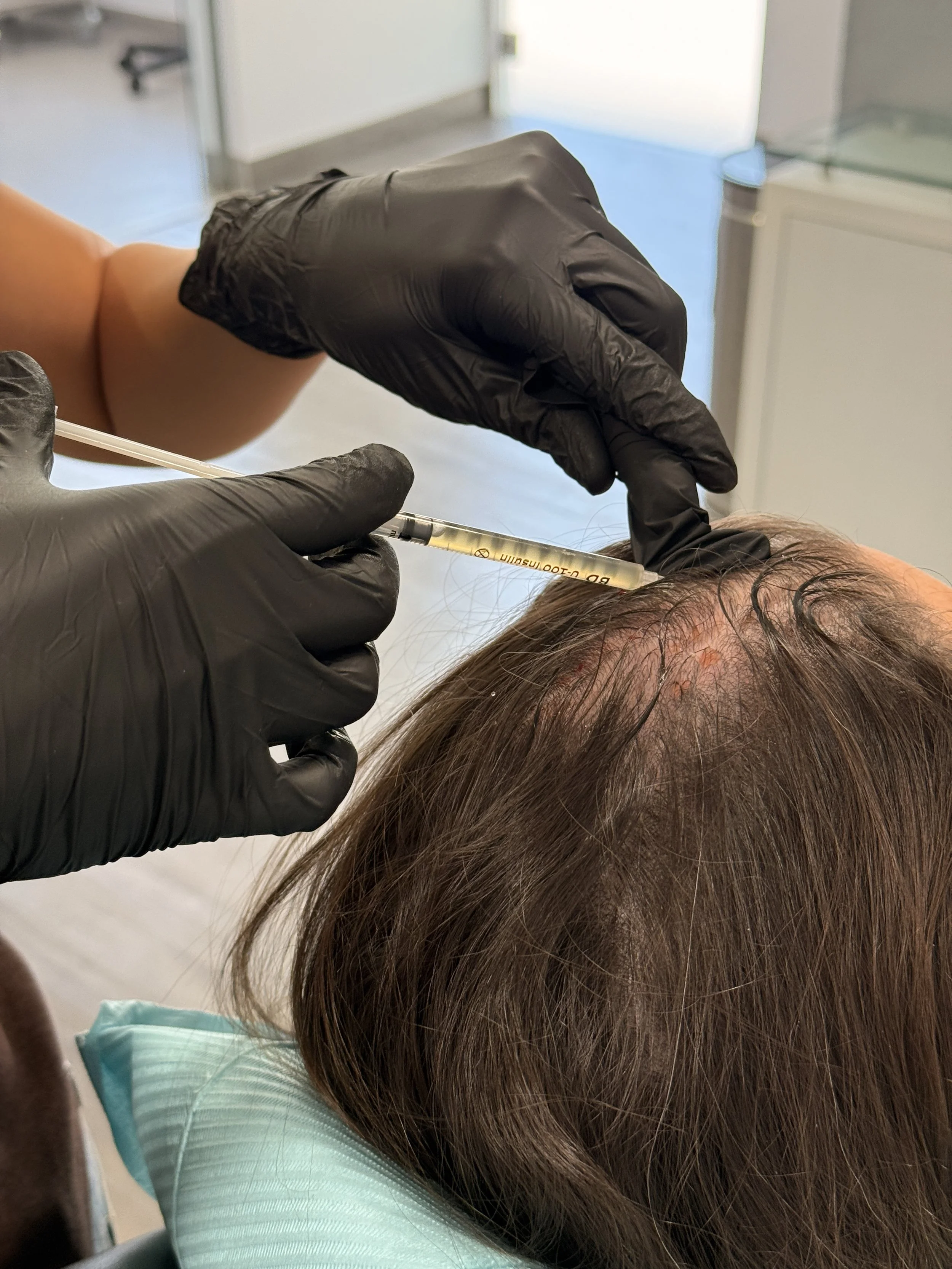 plasma rico en plaqueta.JPG