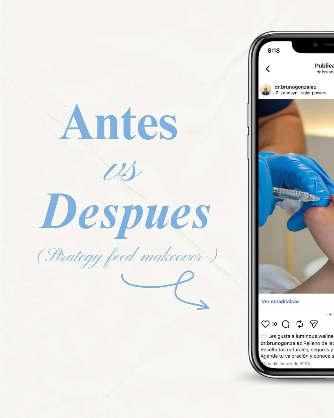 As&iacute; se ve el antes vs despu&eacute;s del feed del Dr. Bruno 👀
Un cambio en la forma de presentar su contenido y su imagen en redes ✨
📩 Si est&aacute;s pensando en trabajar tu presencia digital, escr&iacute;benos.

#feed #agenciademarketing #