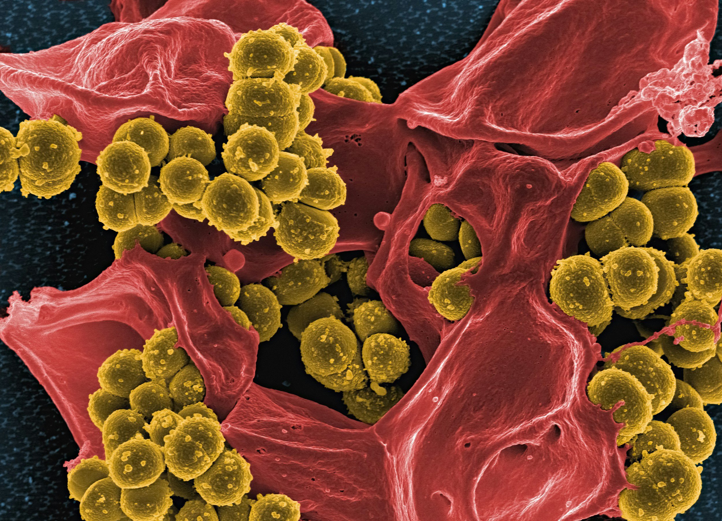 The Connection Between Gut Health and Brain Fog: Why Your Stomach Might Be the Key to Clearer Thinking