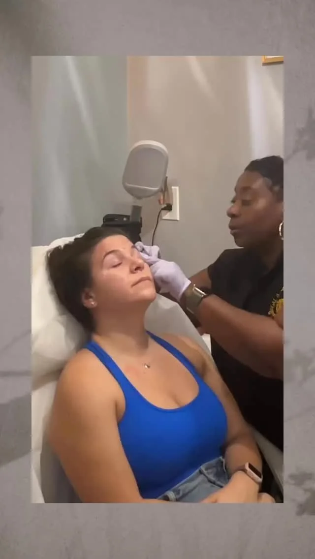 Friendly reminder, beauties! π If your last tox treatment was between December and February, it’s time for a refresh! Book your appointment now and keep that glow going strong. β¨
#ToxTime #RegalRefresh #Xeomin #nurseinjector #toxinabutolinica