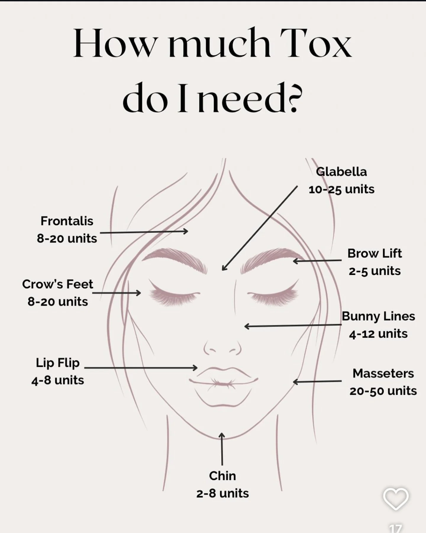 Curious about how many units of toxin you might need for a refreshed look? Each area of the face requires a different approach! From smoothing forehead lines with 10-20 units to softening crow’s feet with 5-15 units per side, we customize each