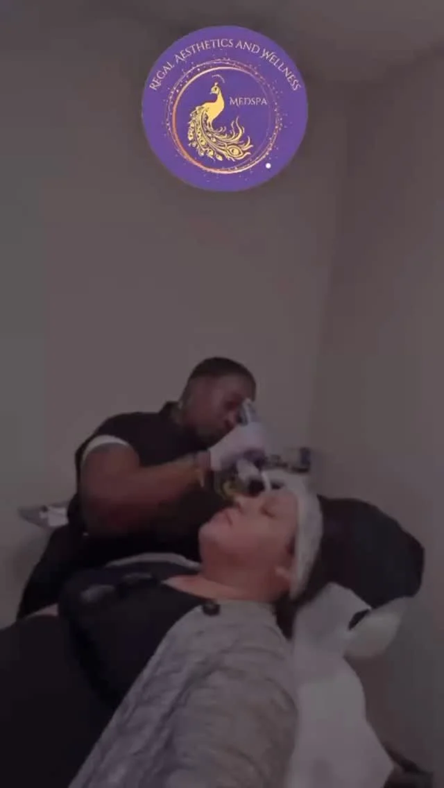 Our Regal Radiance Package is here:
βοΈ 3 Microneedling treatments – $1050
βοΈ PLUS 3 complimentary B12 shots
βοΈ Upgrade your treatment with PRP add-on for just $250/session
Your skin loves consistency — and that’s where results trul