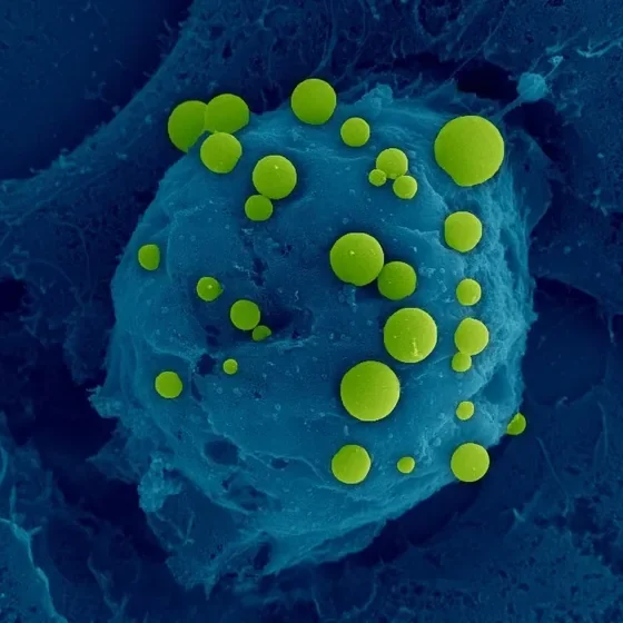Scanning electron microscope image showing green BubbleFect biomolecular condensates of varying sizes on the surface of a teal-coloured cell