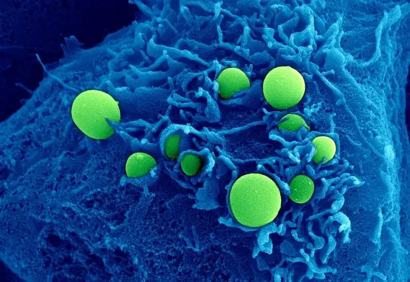 Scanning electron microscope close-up of green BubbleFect biomolecular condensates nestled within the ruffled surface of a blue cell