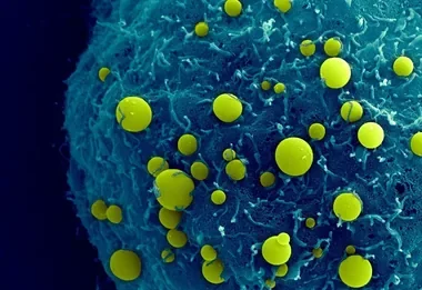 Scanning electron microscope image of yellow BubbleFect biomolecular condensates of varying sizes scattered across the fibrous surface of a teal cell