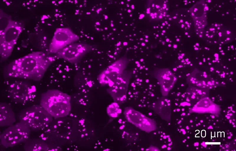 Fluorescence microscopy image showing magenta BubbleFect biomolecular condensates inside and around transfected cells, scale bar 20 µm