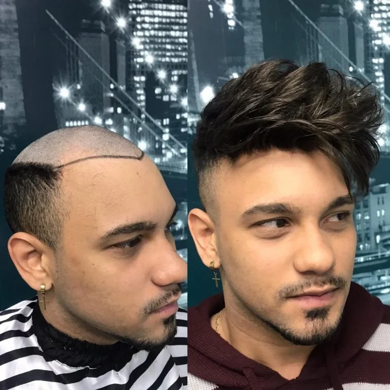 Homem com cabelo raspado e linhas traçadas na cabeça à esquerda; cabelo cheio e estilo moderno à direita, ambos com fundo de cidade iluminada à noite.