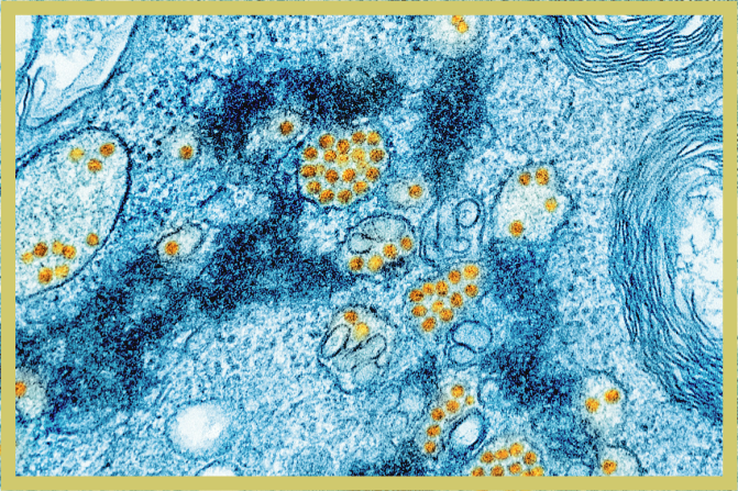 Council on Foreign Relations: Preventing and Preparing for Pandemics With Zoonotic Origins
