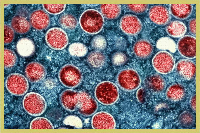 The Hill: New World Bank pandemic fund must prioritize prevention