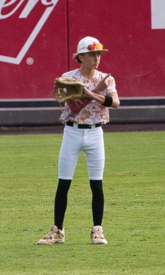 A young baseball player in a camouflage jersey and black kneepad is pitching a ball on the field. He is wearing a green cap and pink arm sleeves, with a glove on his left hand. He is mid-throw on a dirt infield, with an outfield fence and trees in the background.