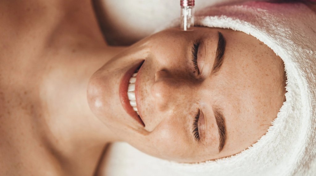 Microneedling vs Morpheus8 vs Forma