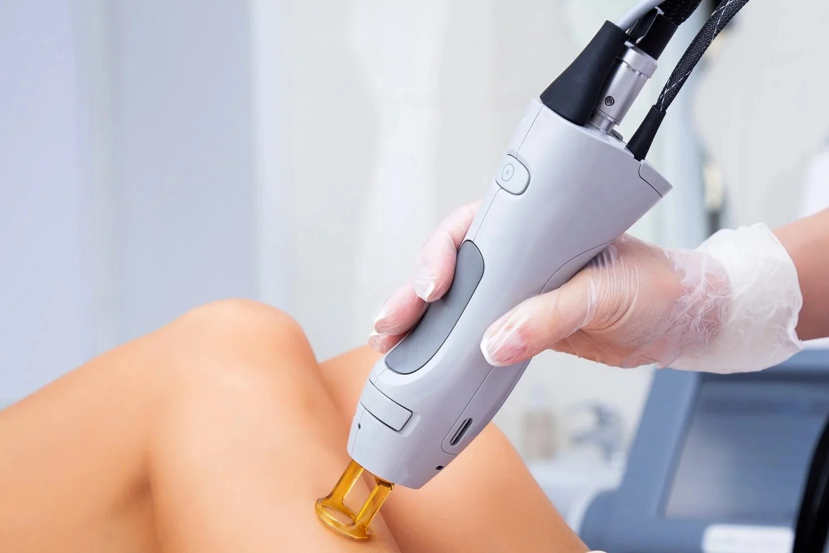 A person receiving laser skin treatment on their leg, with a medical device emitting laser light, in a clinical setting.