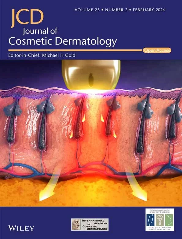 Evaluation of safety and efficacy of a new device for muscle toning and body shaping / Journal of Cosmetic Dermatology 2021