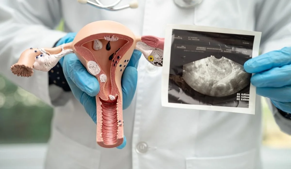 Polycystic Ovarian Syndrome</span>