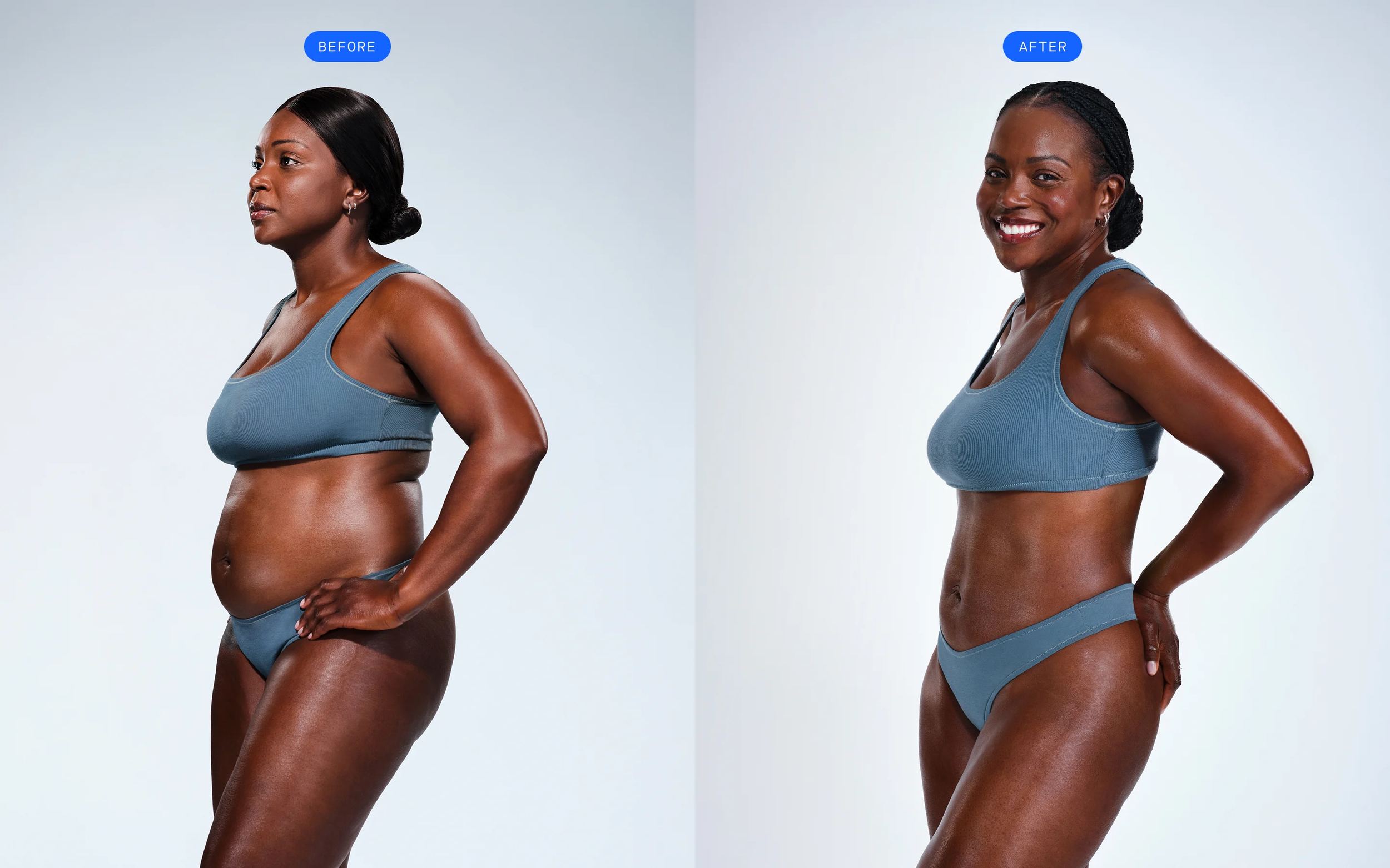 CoolSculpting: Den ultimate guiden til fettfjerning uten kirurgi