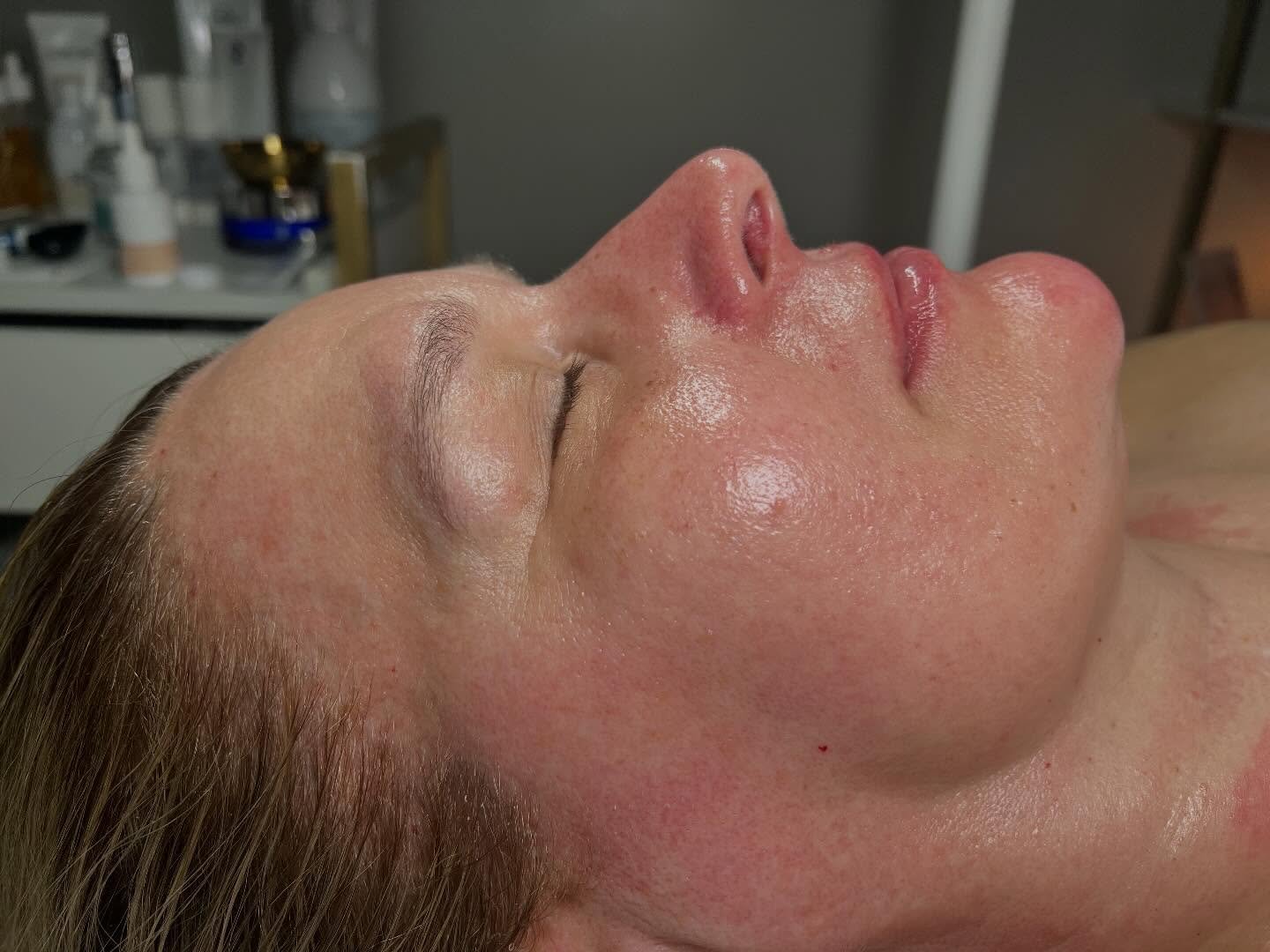 This glow up is the result of our Sculpt &amp; Lift Treatment 

Powered by advanced skin therapy + intentional technique for real, visible results.

The magic behind this transformation:

&bull; CO2 Carboxy Therapy boosts oxygen delivery to the skin,