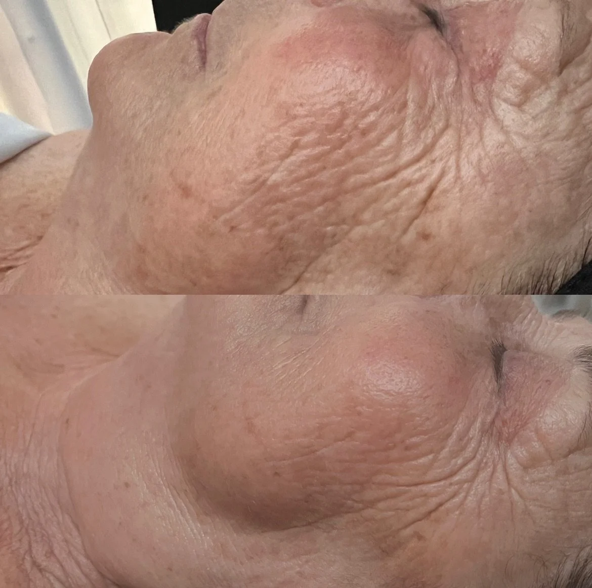 ANTI-AGING 190 - Ageless Firming Facial.jpeg