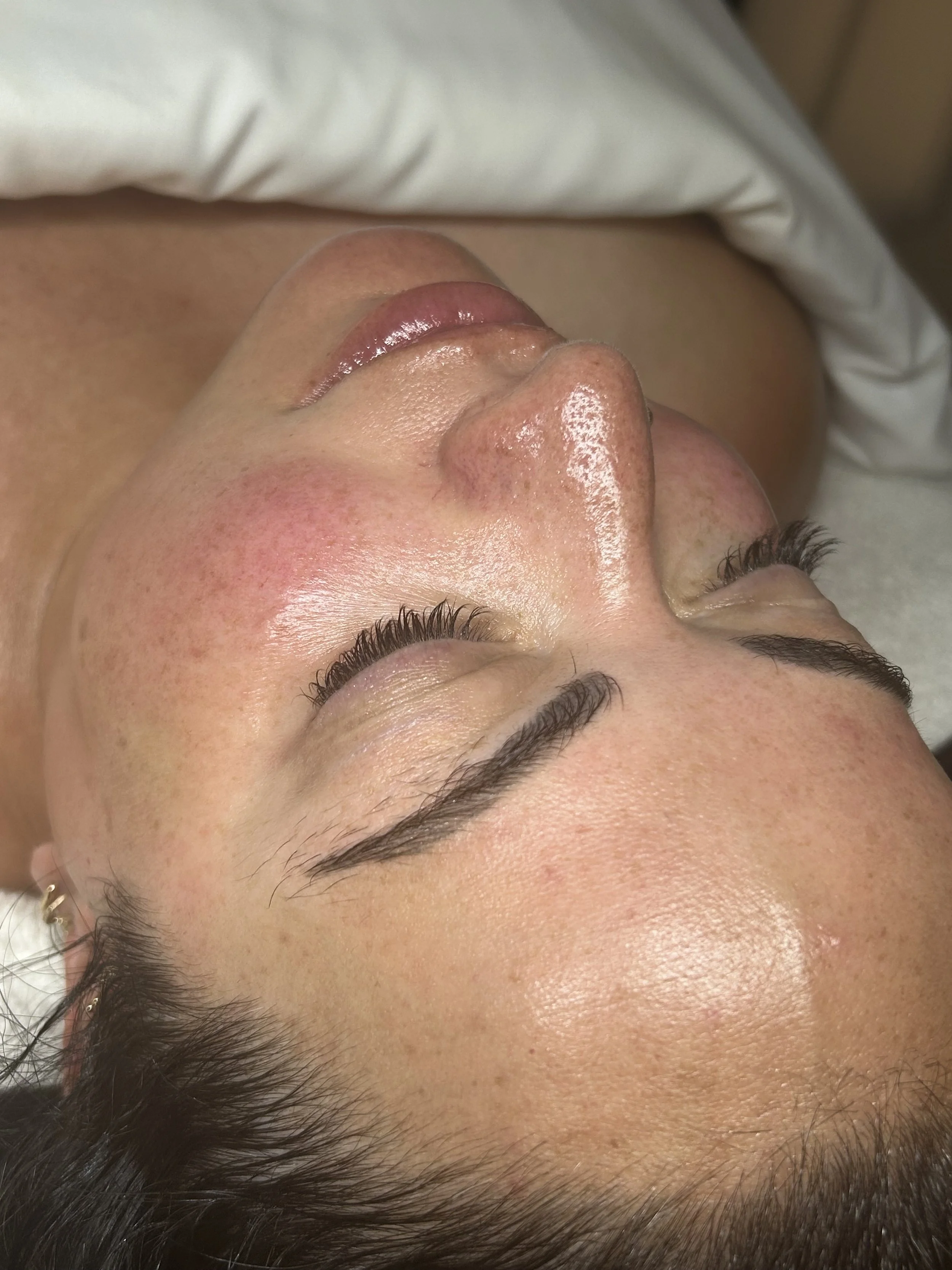 Dermaplane afterglow.jpeg