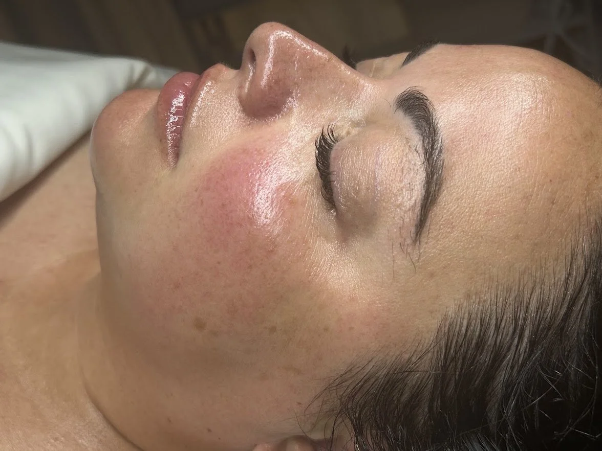 Glowing skin after customized dermaplaning facial at Skin Haven Aesthetics in Eatontown NJ