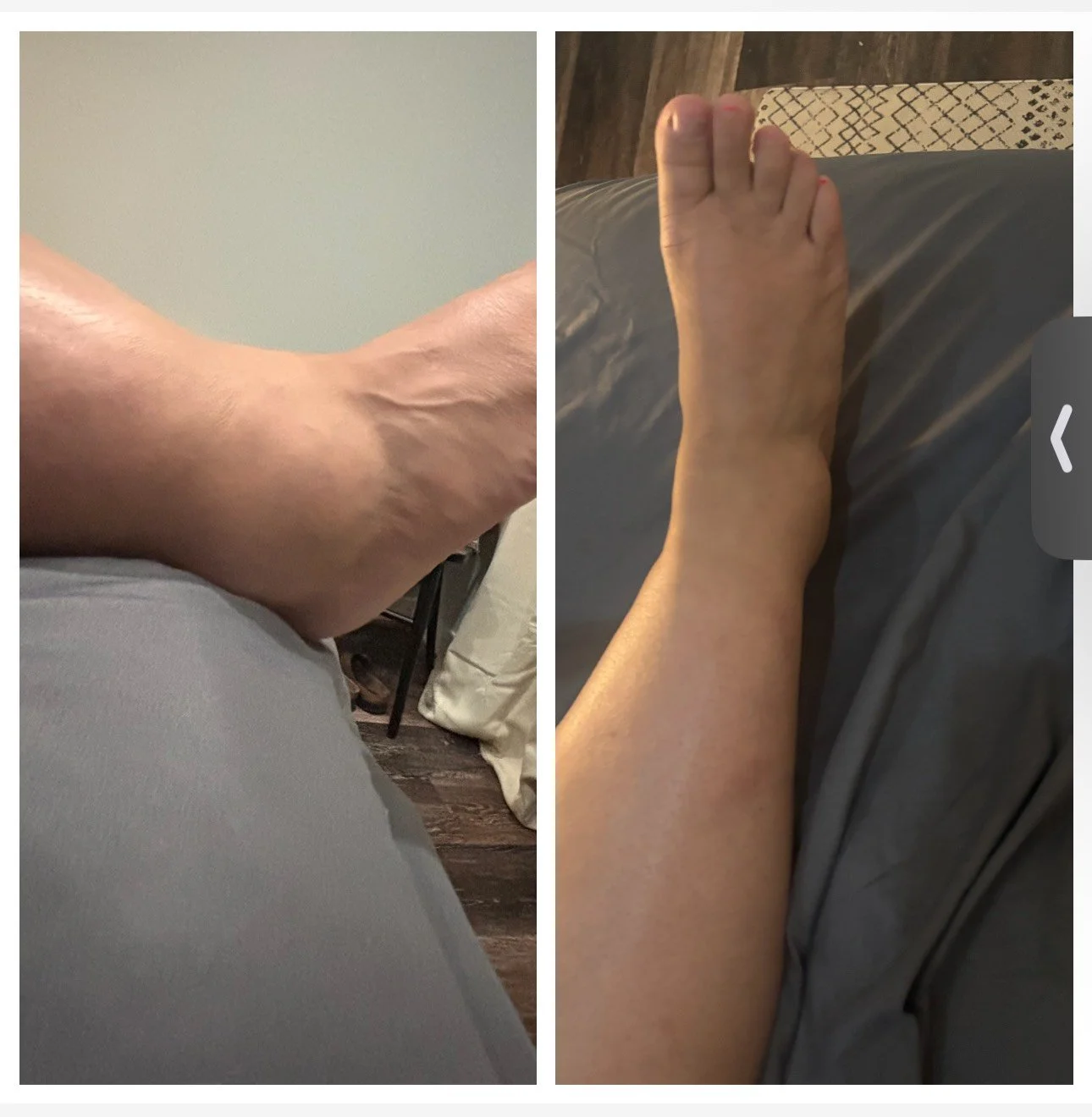 Lymphatic Drainage 1 session