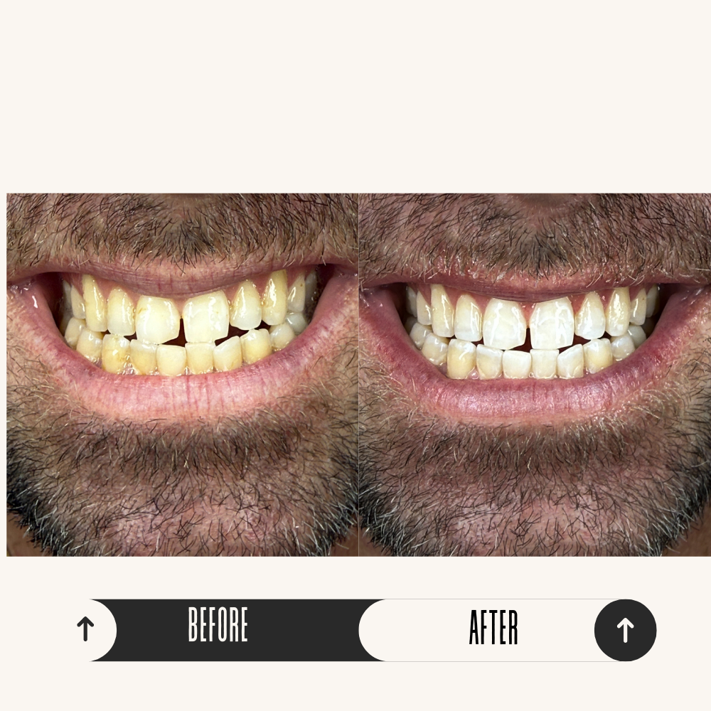 BA5.png
