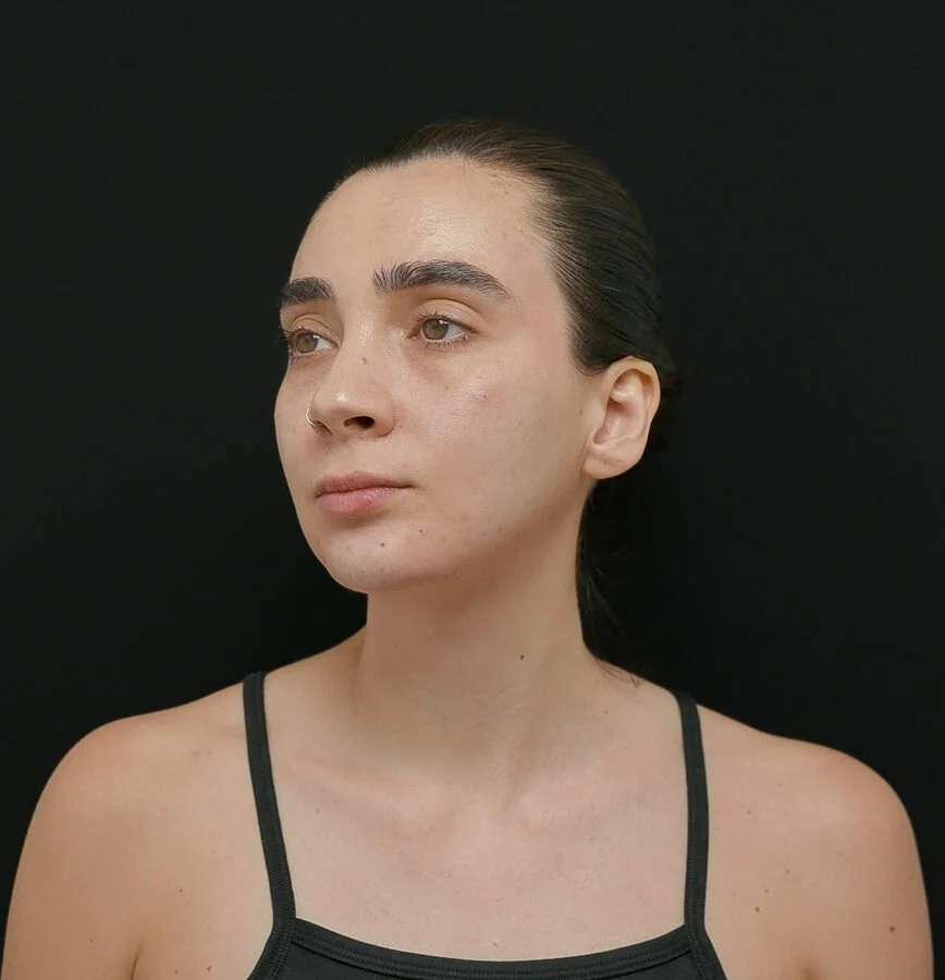 gabby-after-oblique.jpg