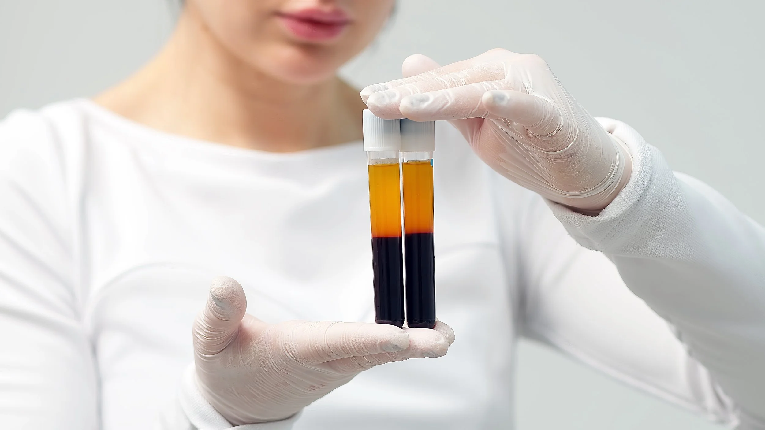 The Complete Guide to PRP Hair Treatment: From First Session to Visible Growth