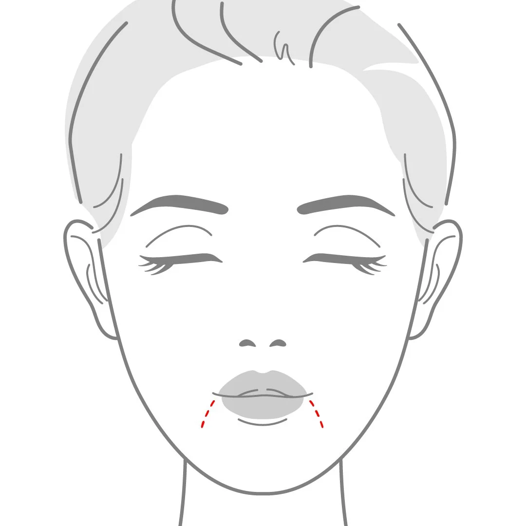 Drooping Mouth-100.jpg