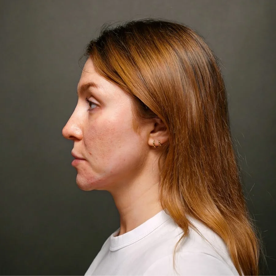 freixnet-after-side.jpg