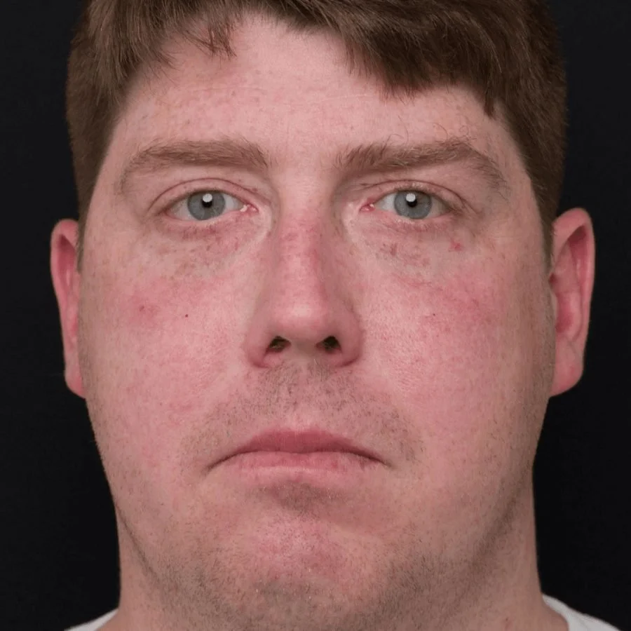 jeremy-after-front.jpg
