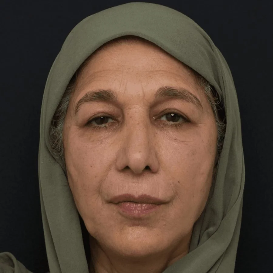 shaista-after-front.jpg
