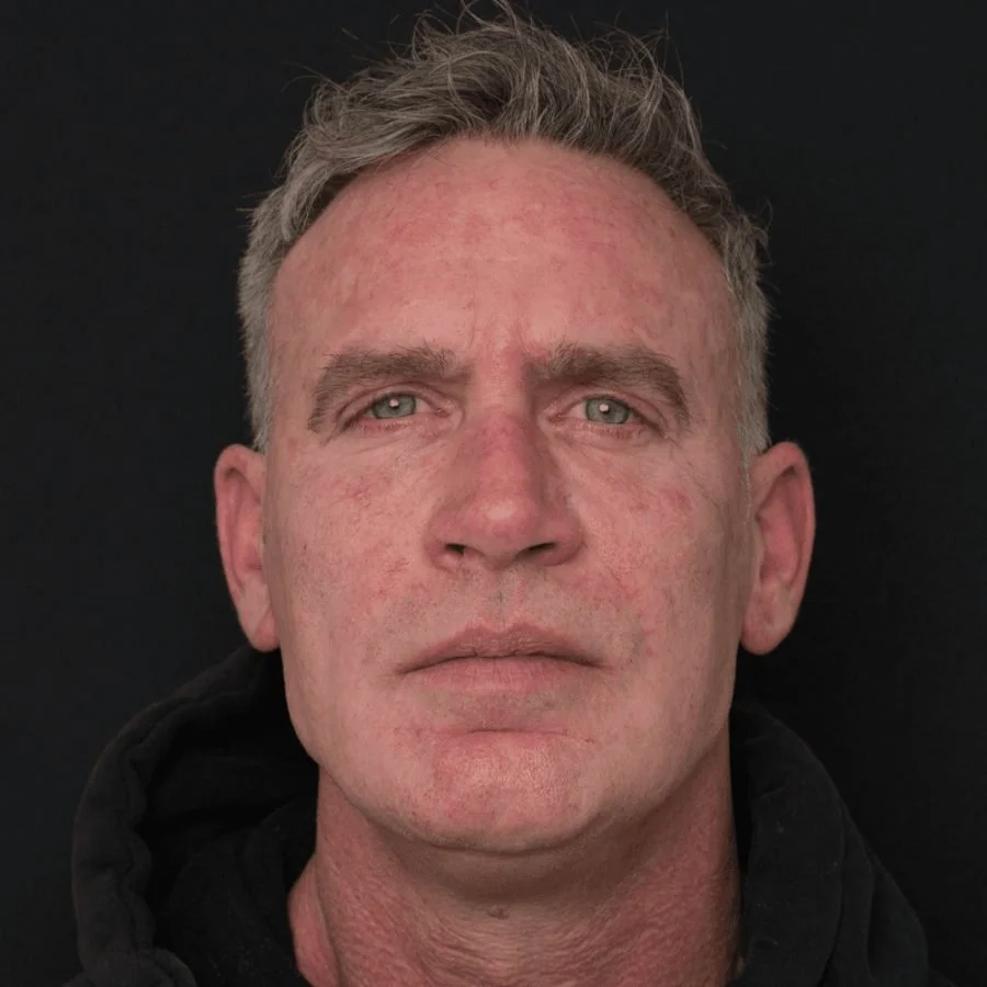 alan-after-front.jpg