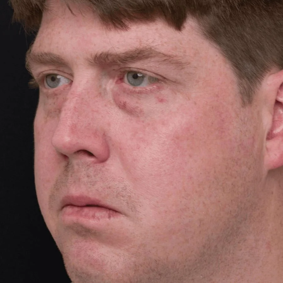 jeremy-before-side.jpg