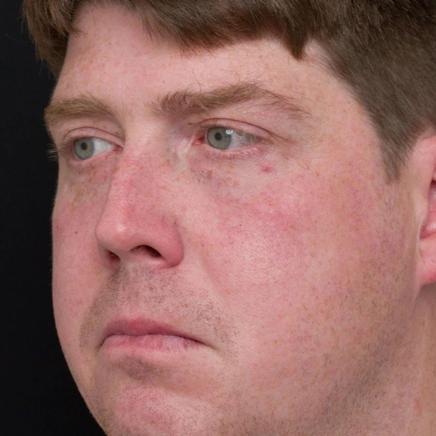 jeremy-after-side-v2.jpg