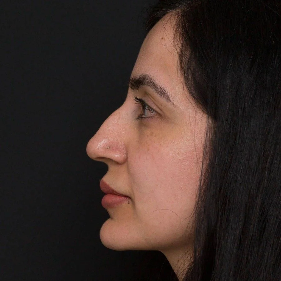 samia-before-right-v2.jpg