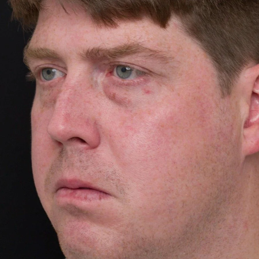 jeremy-before-side-v2.jpg
