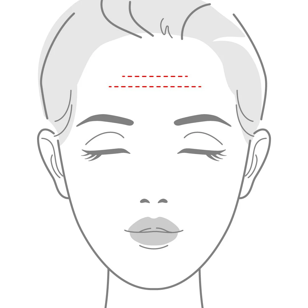 Horizontal Forehead Lines-100.jpg