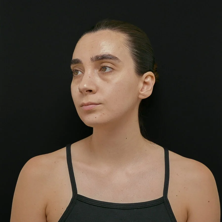 gabby-before-oblique.jpg