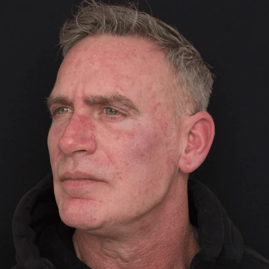 alan-after-side.jpg