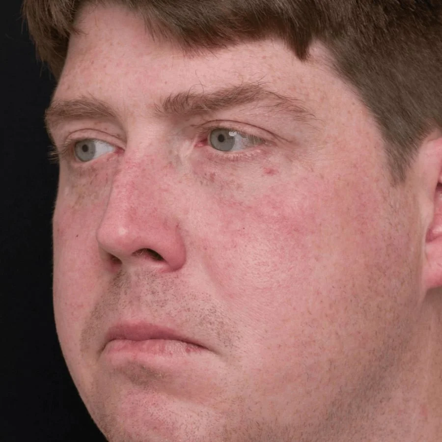 jeremy-after-side.jpg